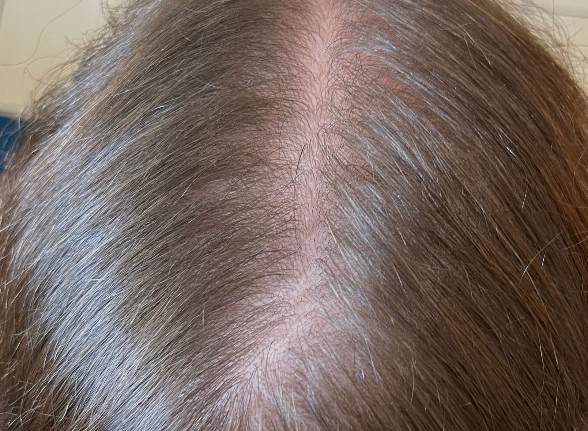 Strona główna 7 ddf2adff b93e 4b14 8128 9b773cb3e5ce